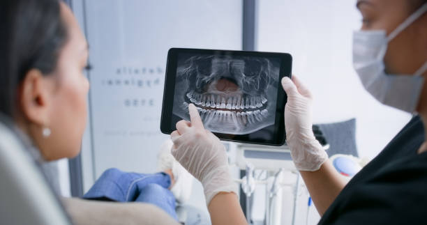 Licensed Tooth Extraction service in Palo Alto, CA - Smile Center Dentistry